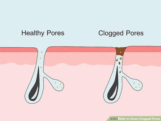 Pore Clogging Ingredients